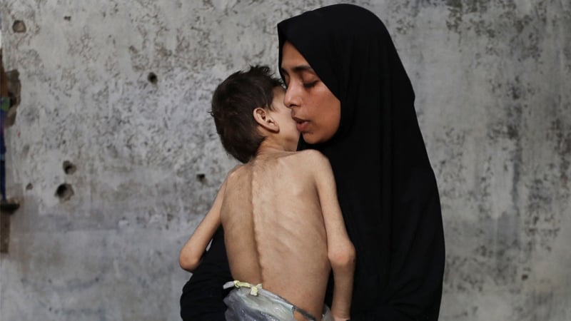 আমরা ধীরে ধীরে মারা যাচ্ছি, আমাদের বাঁচান: গাজার এক মায়ের আকুতি